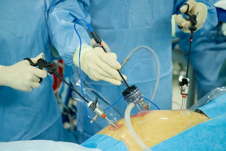 Causes and Risk Factors