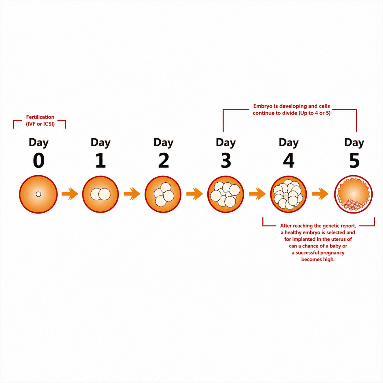 About Preimplantation Genetic Screening (PGT-A)