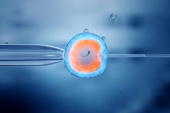 About IVF Treatment